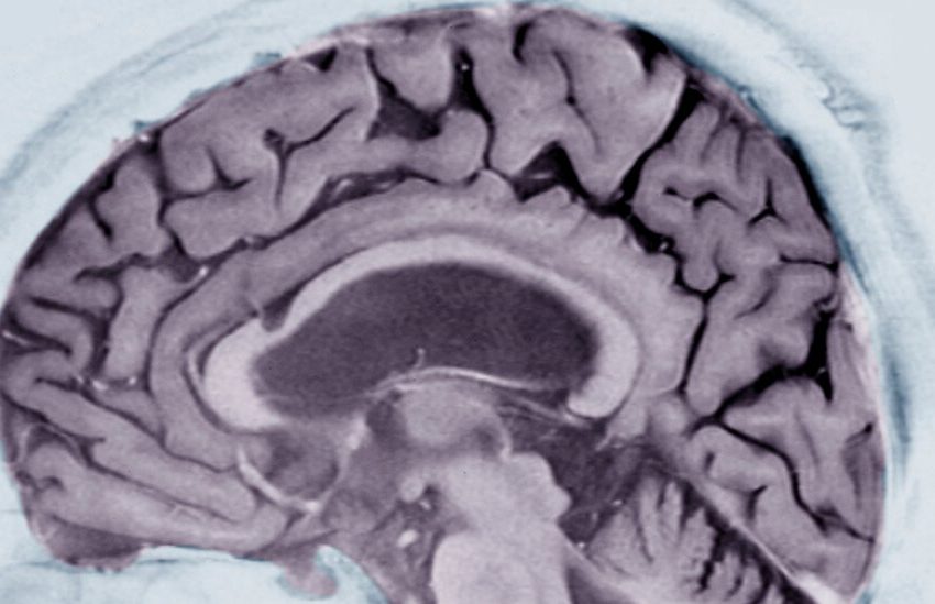  Alzheimer’s Prediction May Be Found in Writing Tests