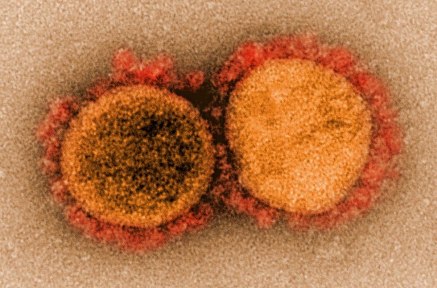  The ‘nightmare scenario’ for California’s coronavirus strain