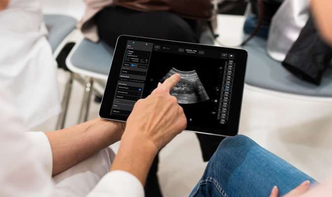  Exo secures $200M toward commercializing ultrasound device