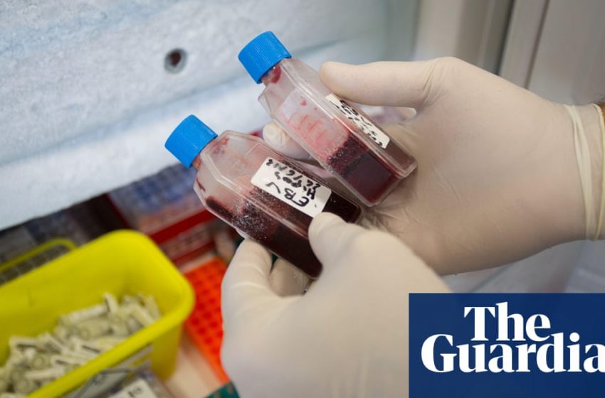  Exclusive: NHS to use AI to identify people at higher risk of hepatitis C