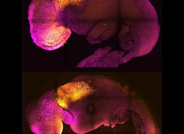  ‘Synthetic’ Embryo With Brain and Beating Heart Grown From Stem Cells