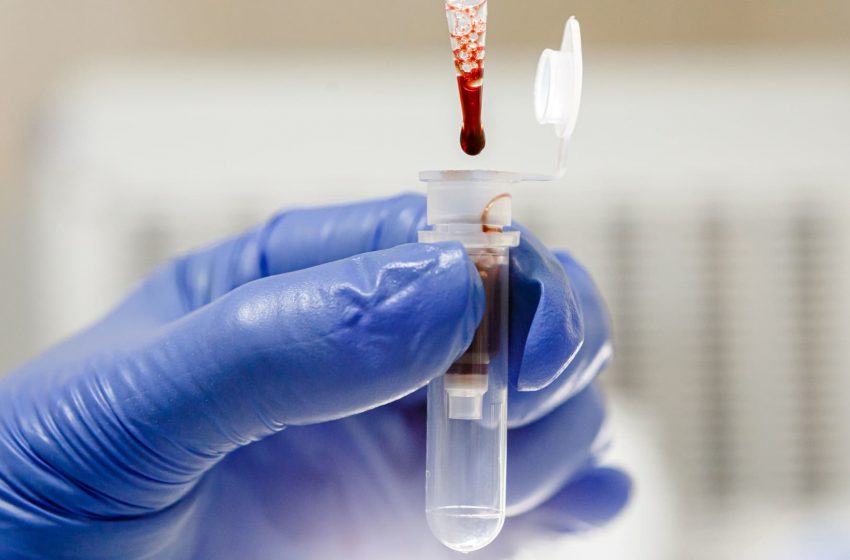  Lab-grown blood given to humans in world-first trial aimed at combatting rare disorders